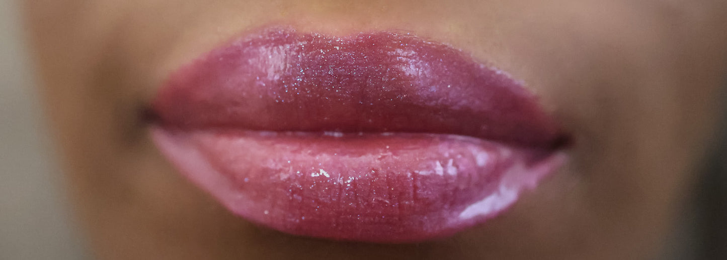 Dazzle